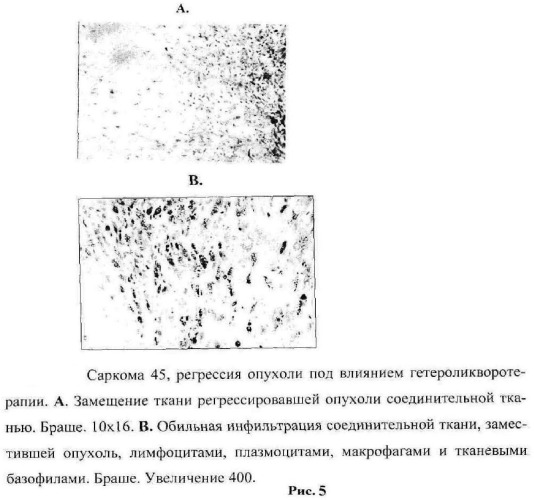 Способ лечения злокачественных новообразований в эксперименте (патент 2475865)