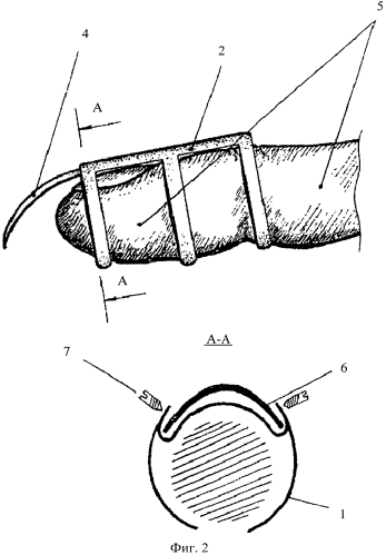 Инструмент для обработки раневой полости (патент 2565832)
