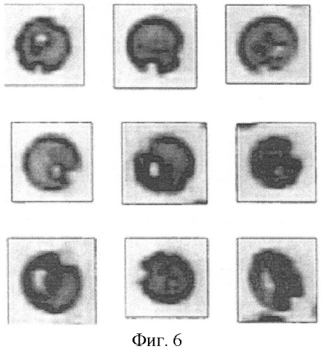 Способ определения уплотненных белково-липидных участков в мембранах эритроцитов различной степени зрелости с помощью компьютерной программы bio vision (патент 2390020)