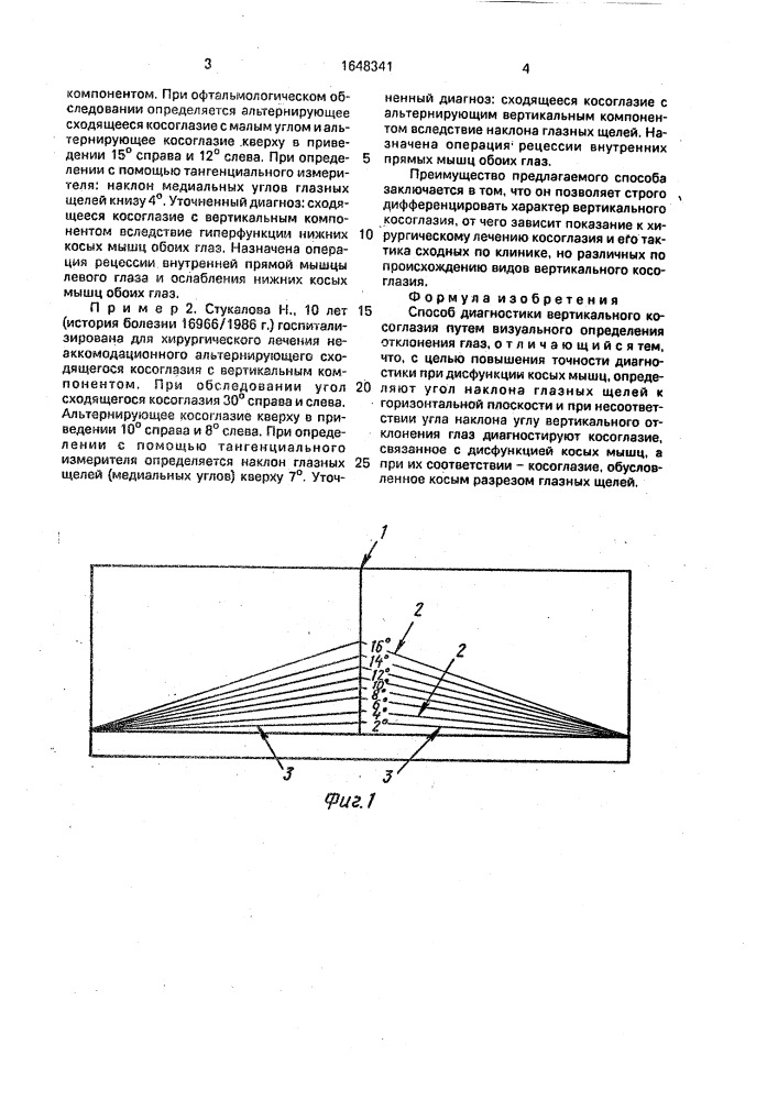 Способ диагностики вертикального косоглазия (патент 1648341)
