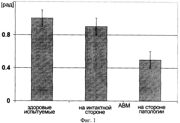 Способ диагностики функционального значения афферентного сосуда артериовенозной мальформации головного мозга (патент 2336017)