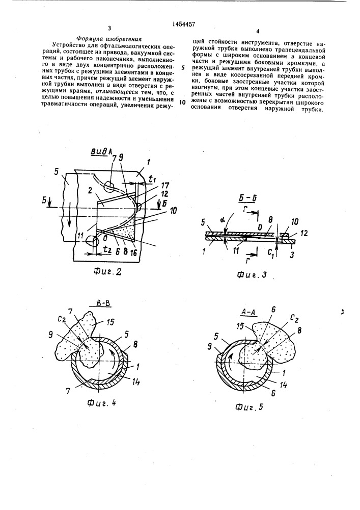 Устройство для офтальмологических операций (патент 1454457)