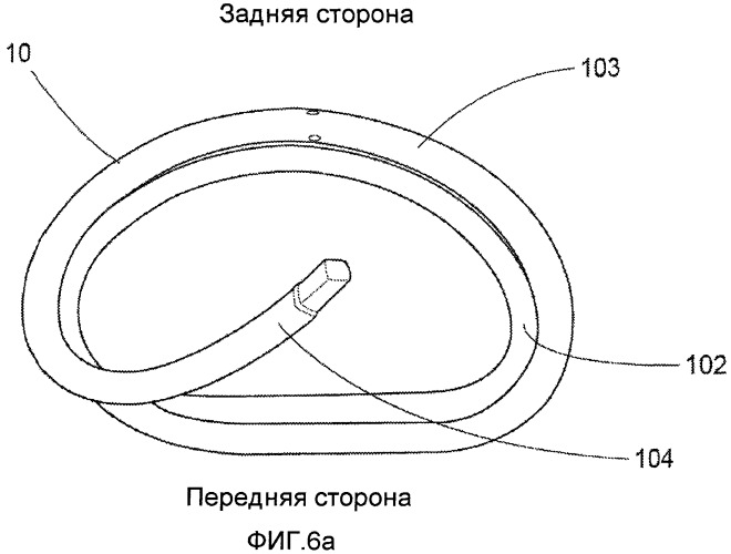 Устройство и способ для уменьшения размера клапана сердца (патент 2491035)