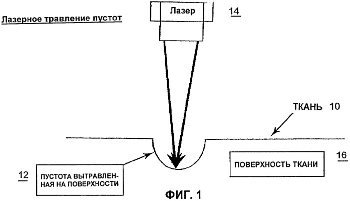 Способ увеличения объема пустот в прессовой ткани путем лазерного травления (патент 2349696)