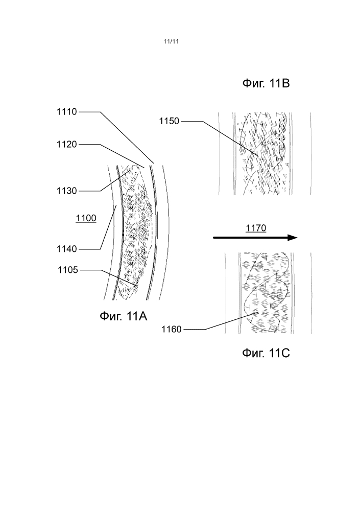 Способ и устройство для офтальмологических устройств, включающих участки жидкокристаллической полимерной сетки особой формы из жидкого кристалла (патент 2594367)