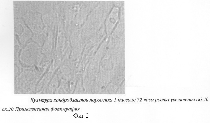 Способ получения донорских хондробластов (патент 2285039)