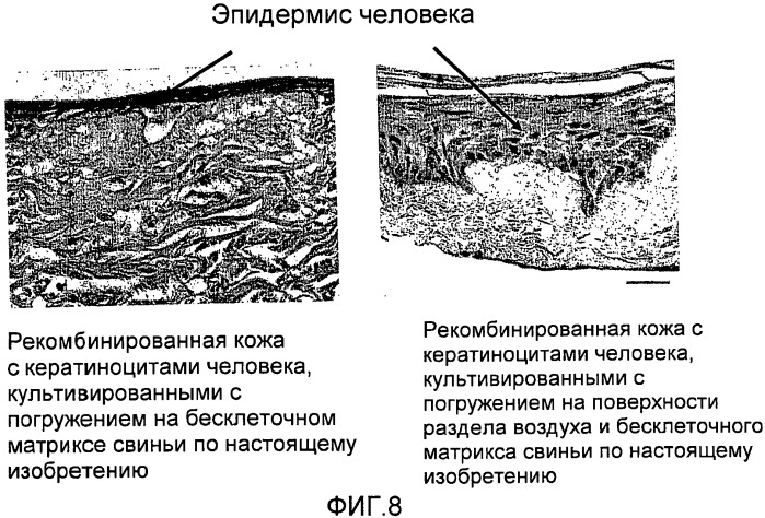 Стерильный аутологичный, аллогенный или ксеногенный имплантат и способ его изготовления (патент 2478403)