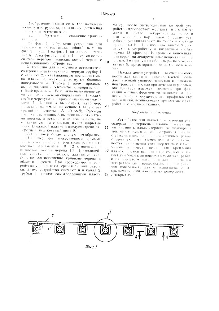 Устройство для накостного остеосинтеза (патент 1526670)