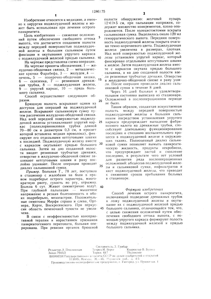 Способ лечения острого панкреатита (патент 1286175)