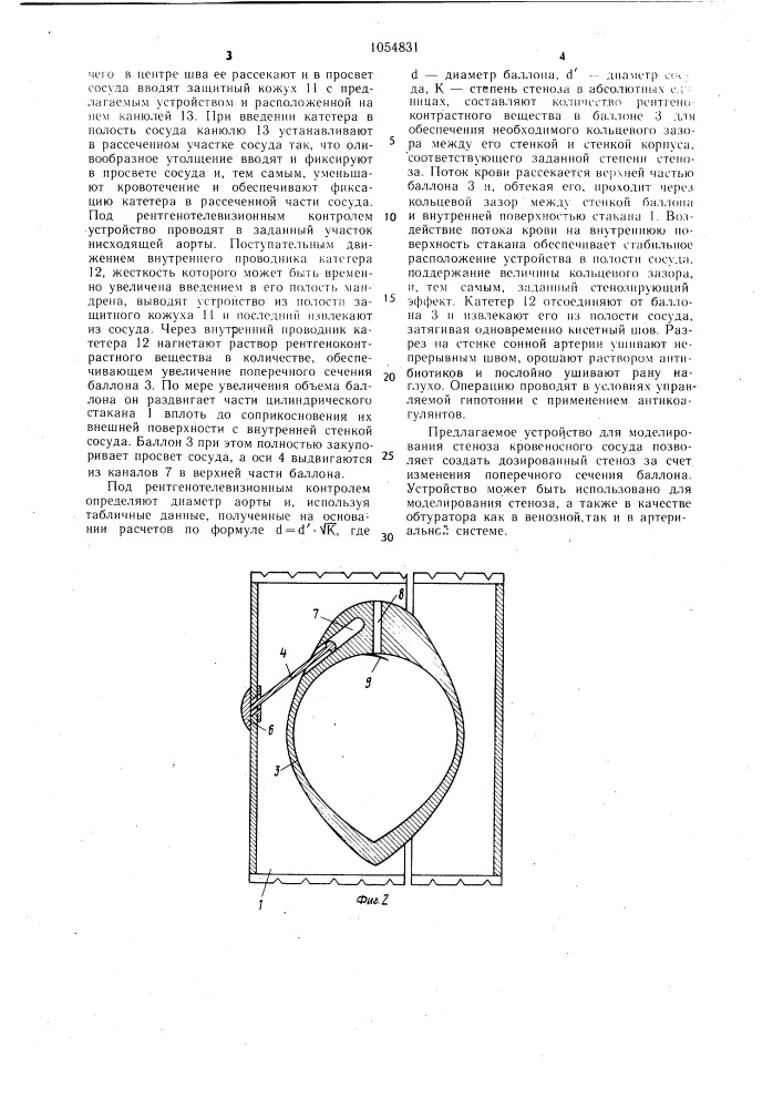 Устройство для моделирования стеноза кровеносного сосуда (патент 1054831)