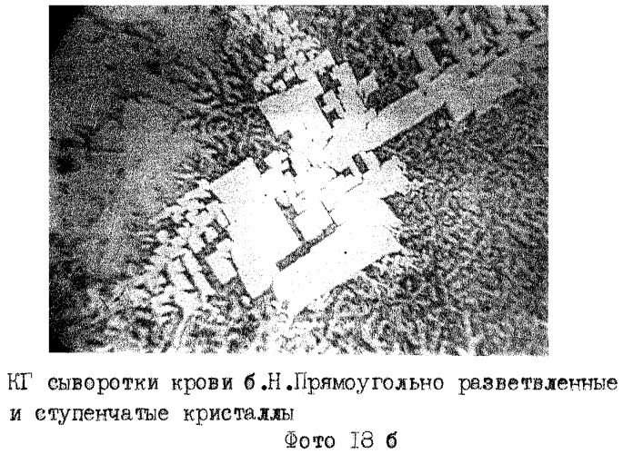 Способ экспресс-диагностики эндогенной интоксикации (патент 2280865)