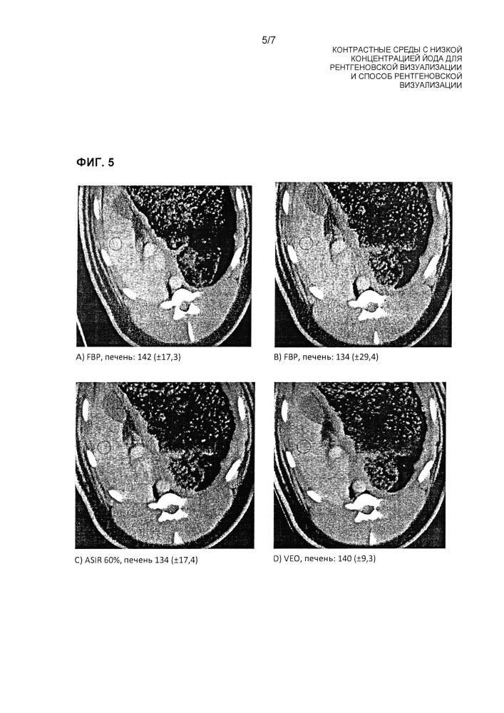 Контрастные среды с низкой концентрацией йода для рентгеновской визуализации и способ рентгеновской визуализации (патент 2664418)