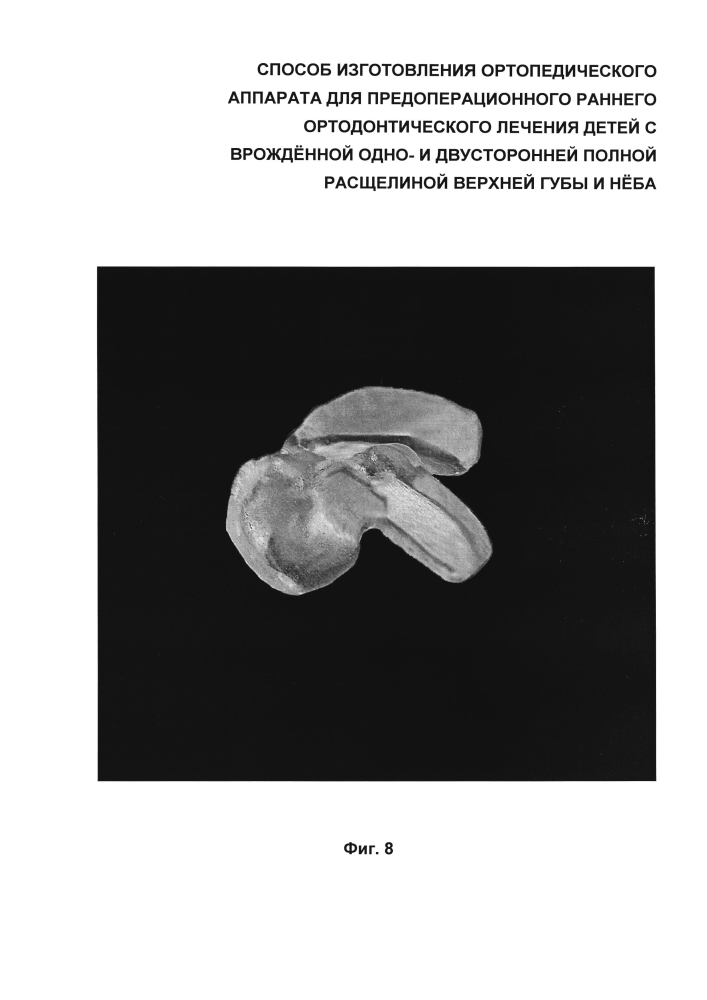 Способ изготовления ортопедического аппарата для предоперационного раннего ортодонтического лечения детей с врождённой одно- и двусторонней полной расщелиной верхней губы и нёба (патент 2599373)