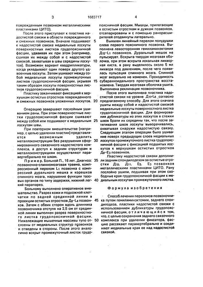 Способ лечения переломов позвоночника (патент 1683717)