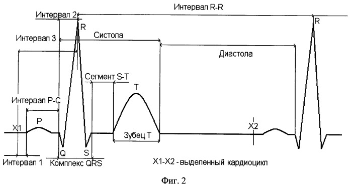 Способ выделения qrs-комплекса электрокардиосигнала (патент 2410023)