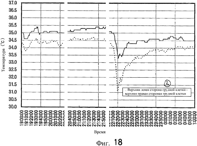 Система контроля биологической информации (патент 2336808)