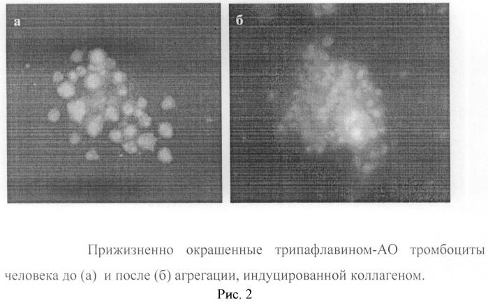 Способ оценки морфофункционального статуса тромбоцитов человека (патент 2485502)