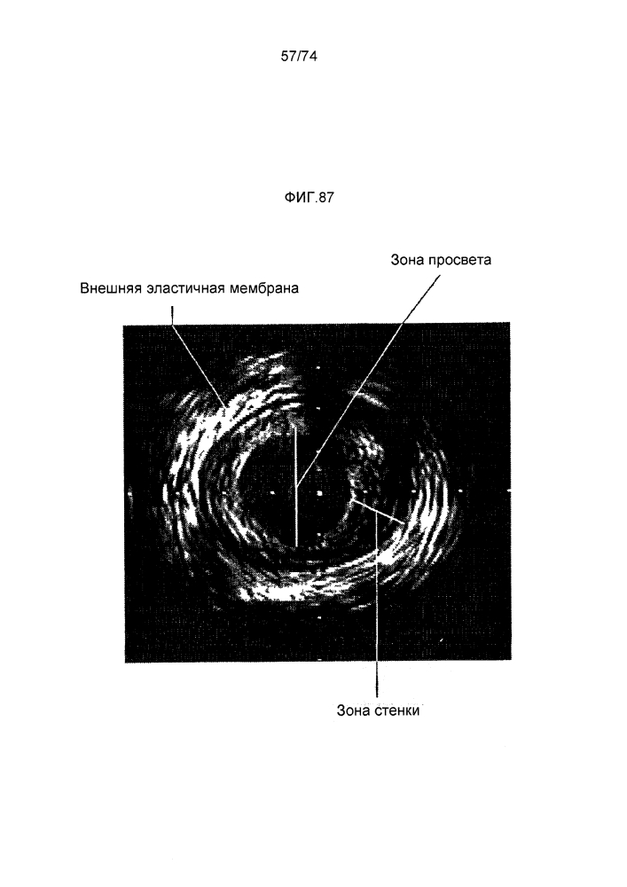 Устройство для локальной и/или регионарной доставки с применением жидких составов терапевтически активных веществ (патент 2596092)