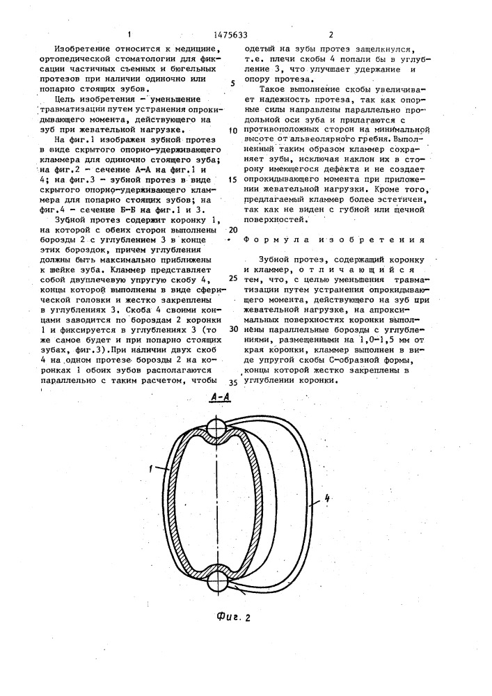 Зубной протез (патент 1475633)