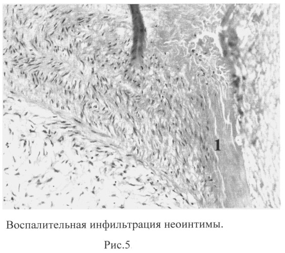 Способ оценки функционального состояния эндотелия экспериментальных животных после реконструктивных операций на брюшной аорте (патент 2503961)