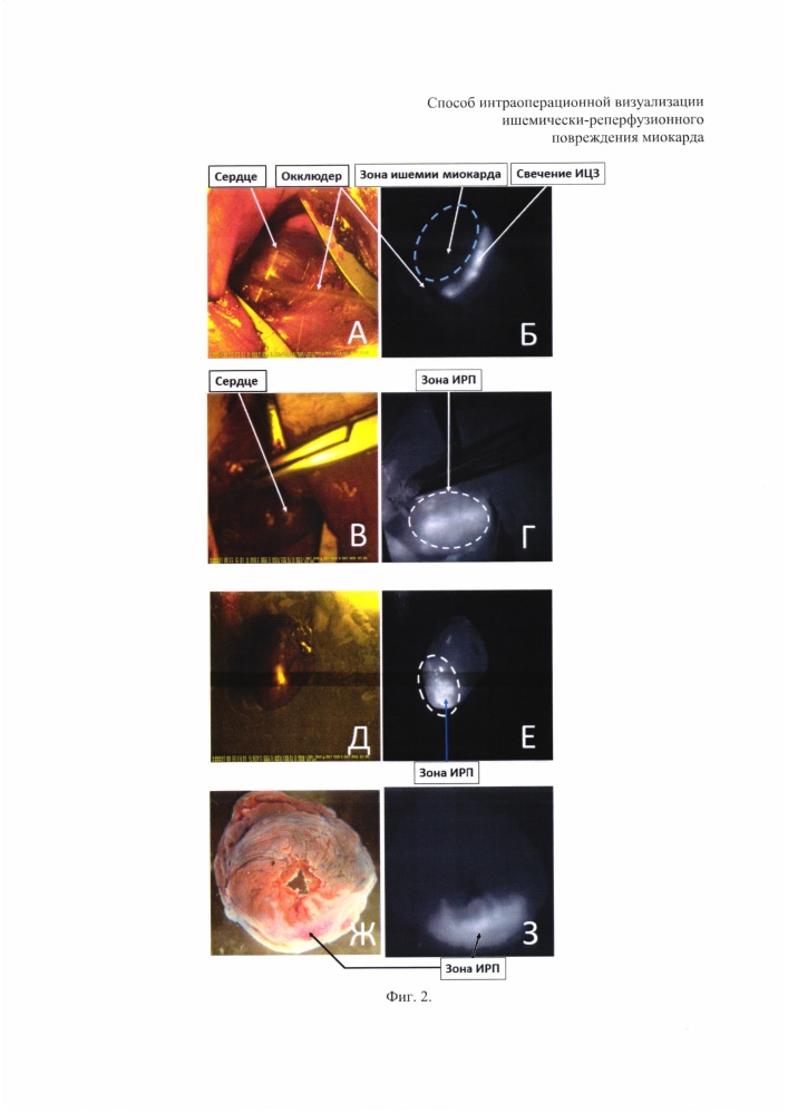 Способ интраоперационной визуализации ишемически-реперфузионного повреждения миокарда (патент 2622983)