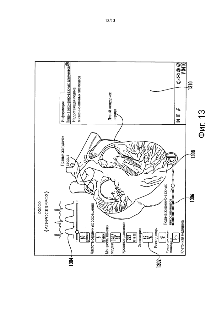 Интегрированная интерактивная система и способ для визуализации физиологического состояния, заболевания, вариантов лечения человека и применения (патент 2654286)