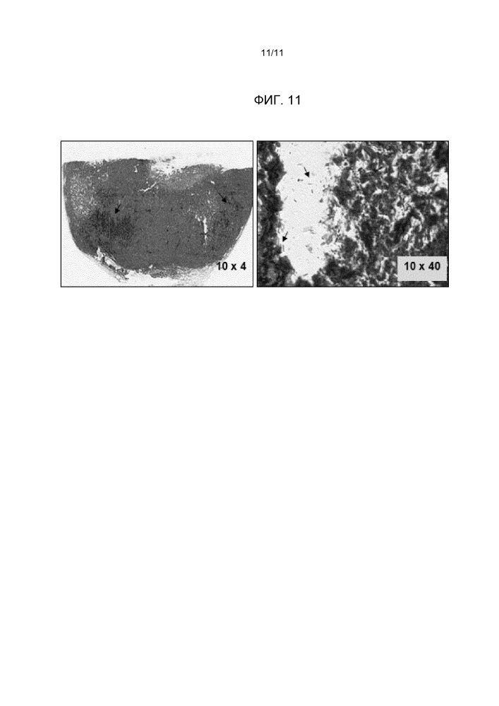 Онколитические штаммы clostridium ghonii, способы получения и применения (патент 2667432)