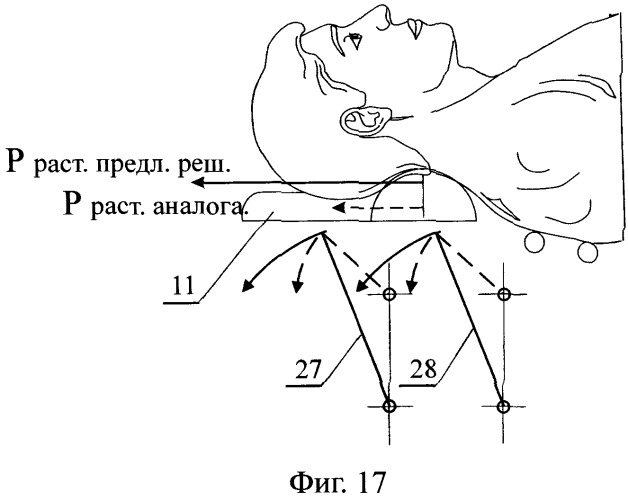 Устройство для коррекции и лечения позвоночника (патент 2250097)
