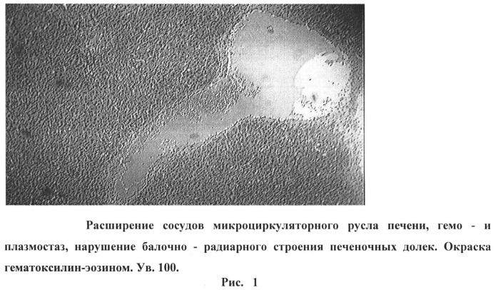 Способ получения метастазов печени в эксперименте (патент 2538243)