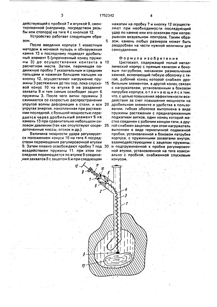Цистоскоп (патент 1752342)