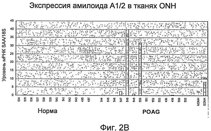 Применение гена сывороточного амилоида а для диагностики и лечения глаукомы и идентификации антиглаукомных агентов (патент 2461378)