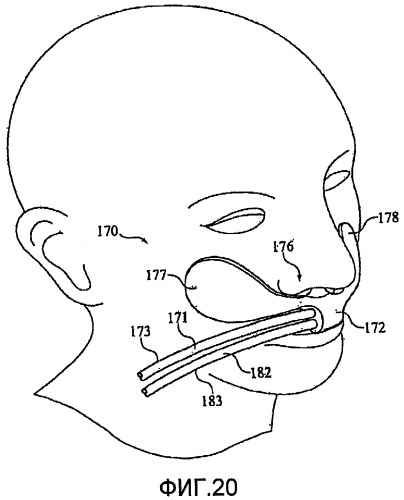 Назальный и оральный интерфейс пациента (патент 2447871)