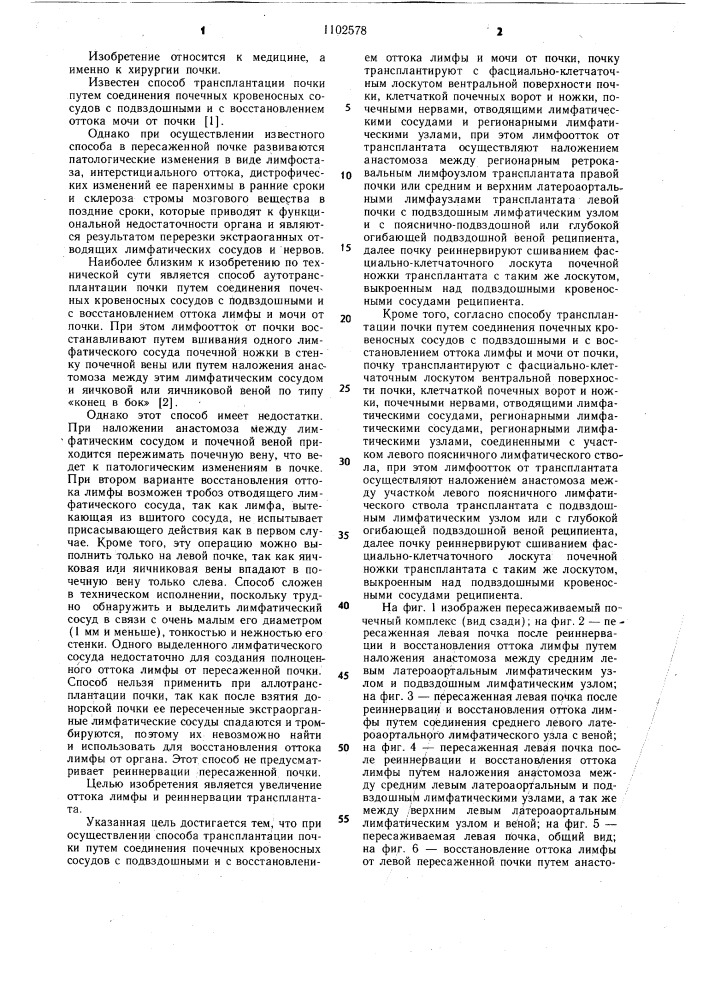 Способ трансплантации почки (его варианты) (патент 1102578)