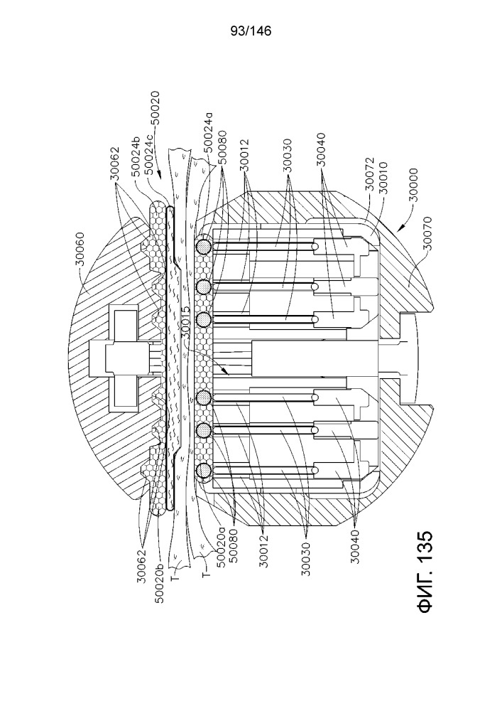 Кассета со скобами, содержащая сжимаемую часть (патент 2655879)