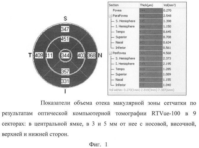 Способ прогнозирования прогрессирования диабетической ретинопатии и диабетического макулярного отека (патент 2520826)
