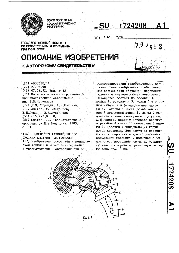 Эндопротез тазобедренного сустава системы д.м.гогуадзе (патент 1724208)