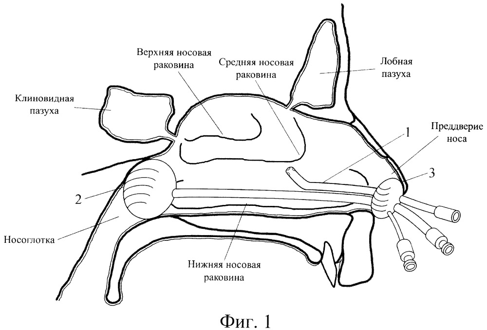 Устройство для консервативной терапии заболеваний носа и околоносовых синусов (патент 2663932)