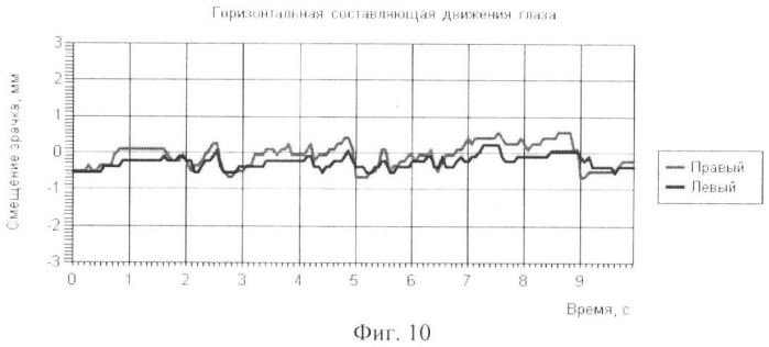 Способ подавления нистагма при движении глаз в различных направлениях (патент 2405406)