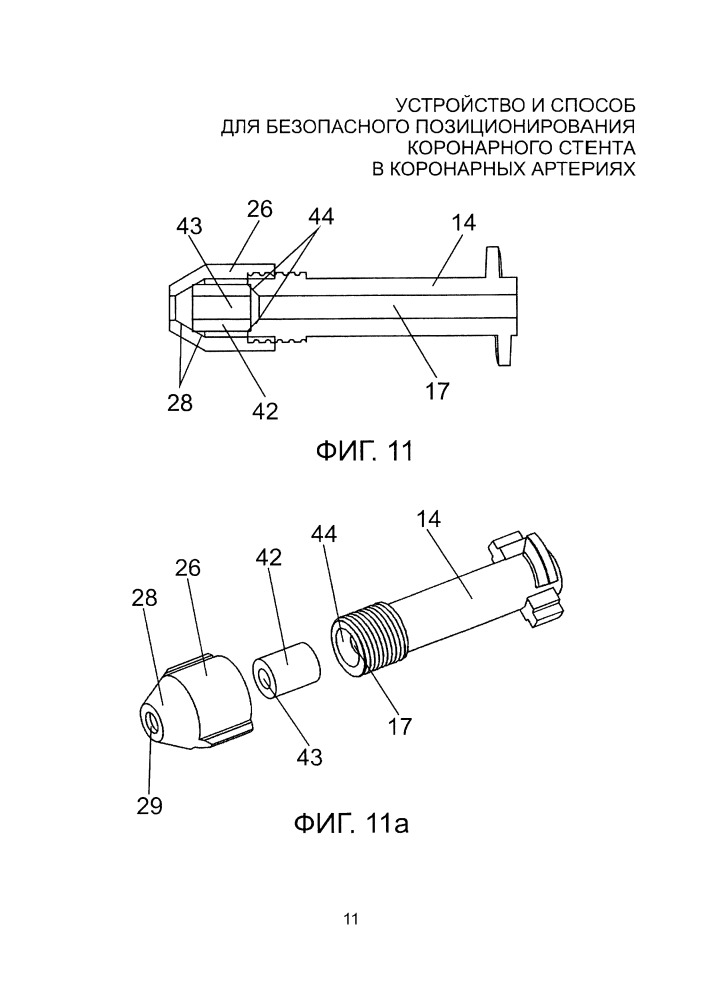 Устройство и способ для безопасного позиционирования коронарного стента в коронарных артериях (патент 2661092)