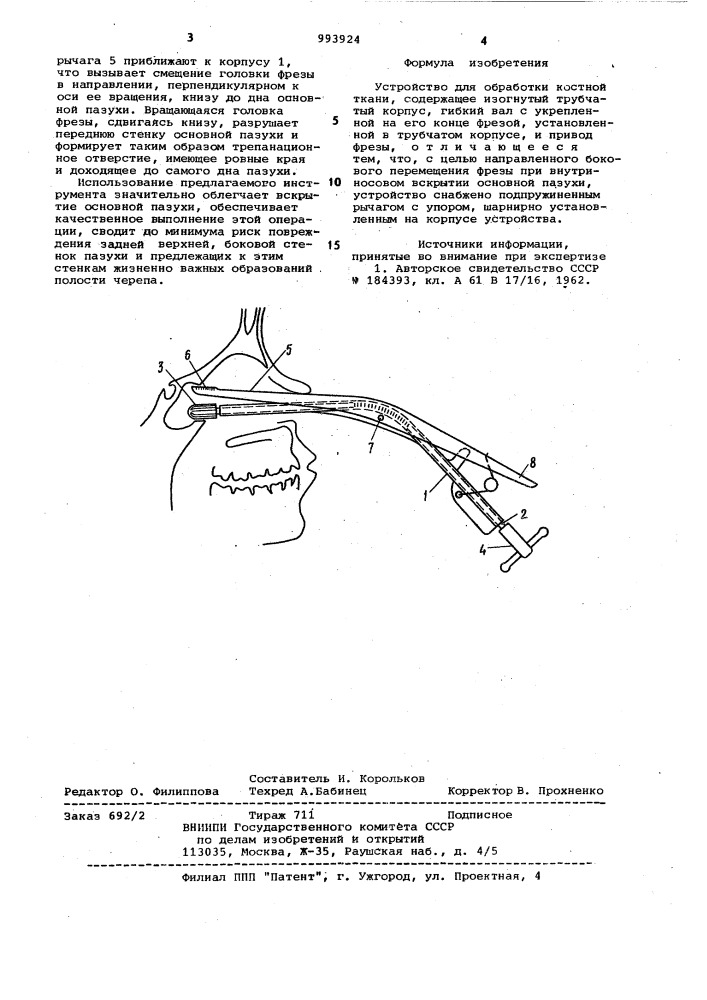Устройство для обработки костной ткани (патент 993924)