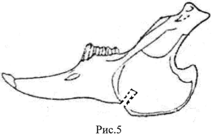 Способ оперативного доступа к нижней челюсти в эксперименте на кролике (патент 2550128)