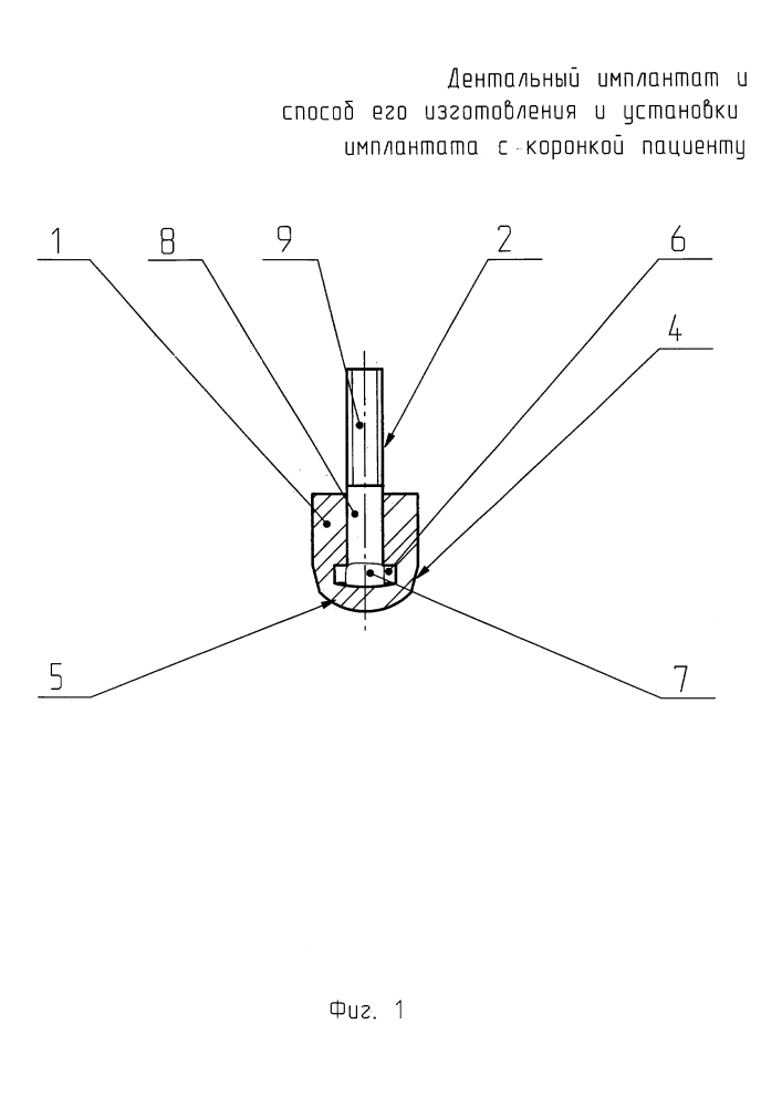 Дентальный имплантат и способ его изготовления (патент 2624169)