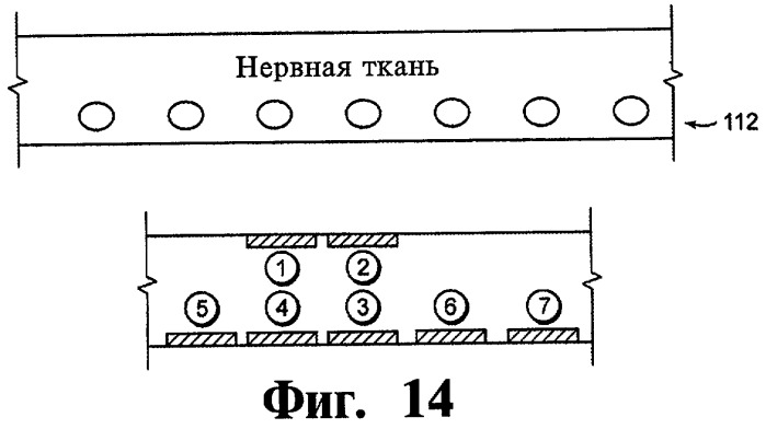 Нейростимулятор и способ стимуляции нервной ткани (патент 2465930)