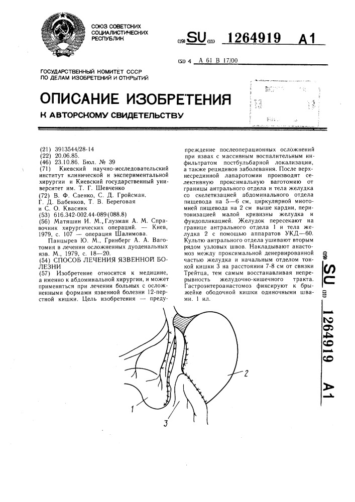 Способ лечения язвенной болезни (патент 1264919)