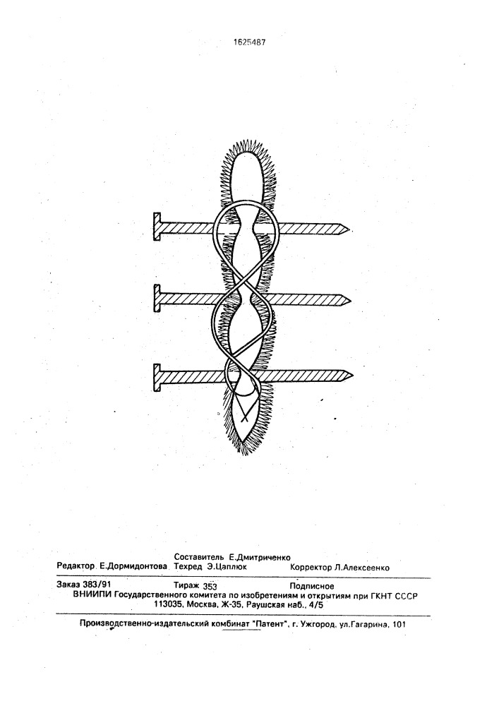 Способ фиксации матки у коров (патент 1625487)