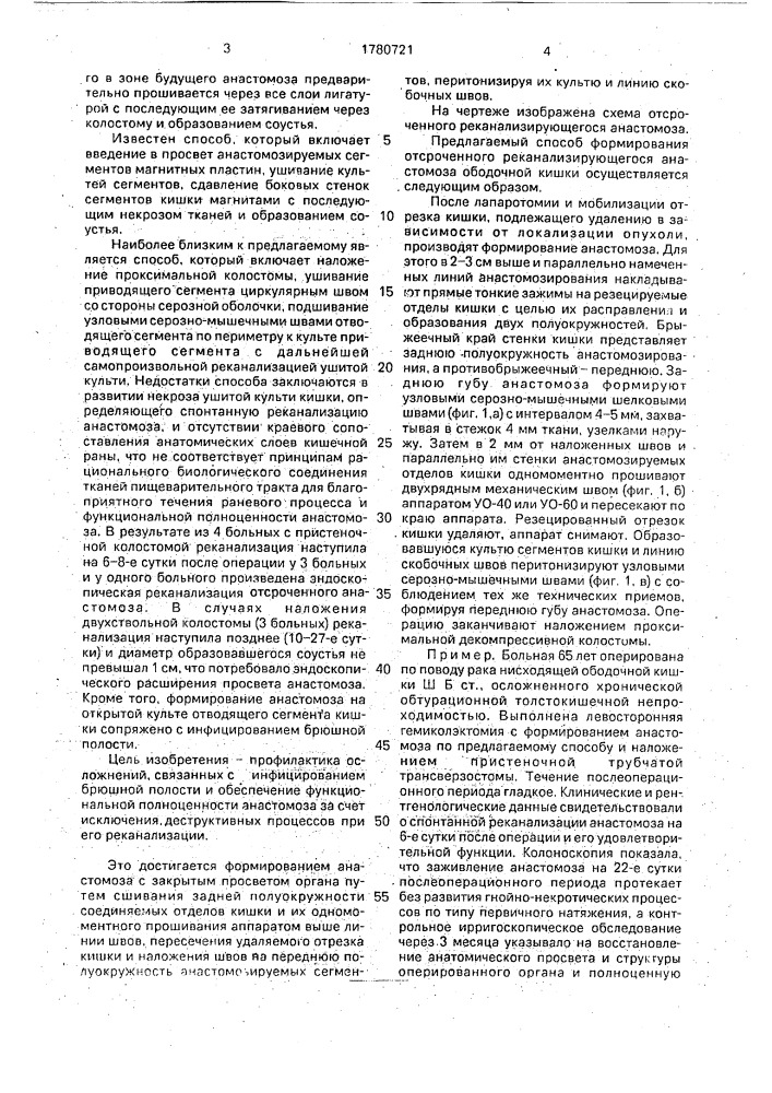 Способ формирования отстроченного реканализирующегося анастомоза ободочной кишки (патент 1780721)