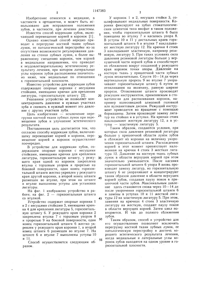 Способ коррекции зубов и устройство для его осуществления (патент 1147383)