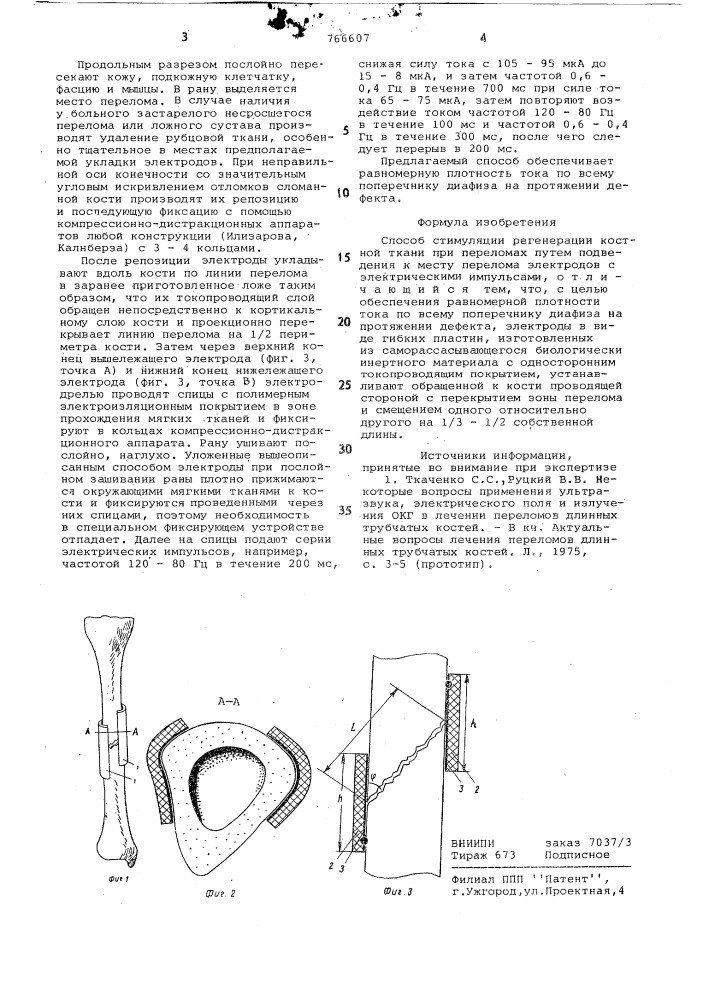 Способ стимуляции регенерации костной ткани при переломах (патент 766607)