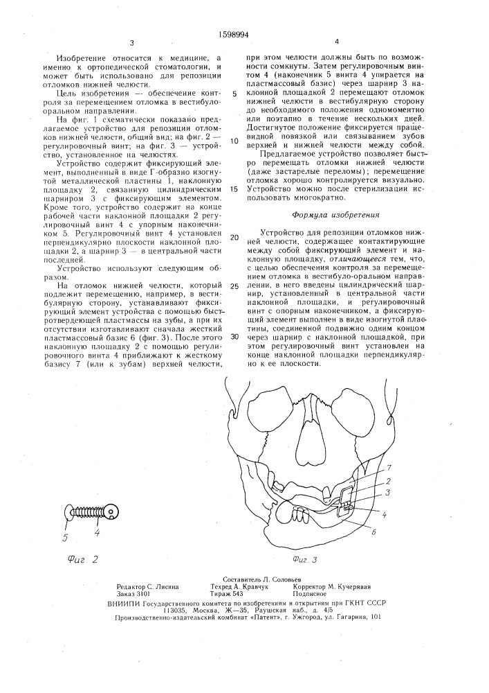 Устройство для репозиции отломков нижней челюсти (патент 1598994)