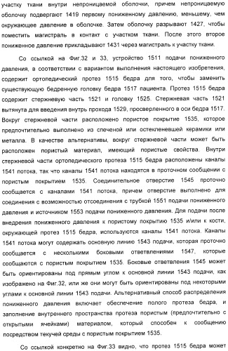 Система и способ продувки устройства пониженного давления во время лечения путем подачи пониженного давления (патент 2404822)